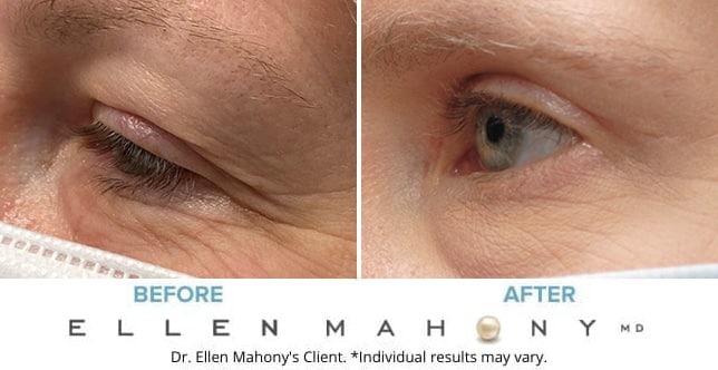 Before and After Image: Case #9071 - left-front-oblique