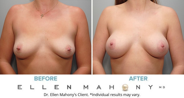 Before and After Image: Case #9097 - front
