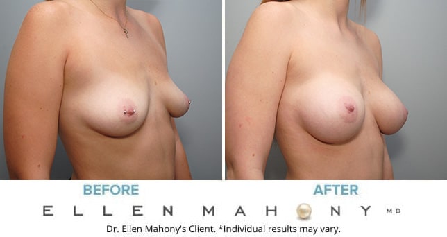 Before and After Image: Case #9097 - right-front-oblique