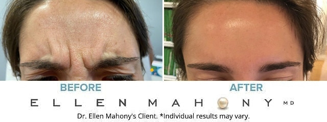 Before and After Image: Case #9112 - front