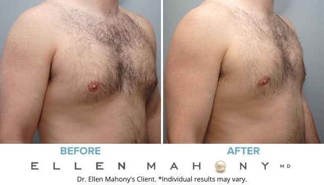 Before and After Image: Case #9150 - right-front-oblique