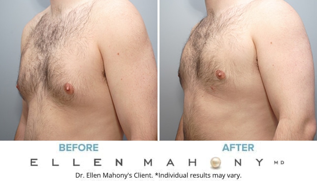 Before and After Image: Case #9150 - left-front-oblique