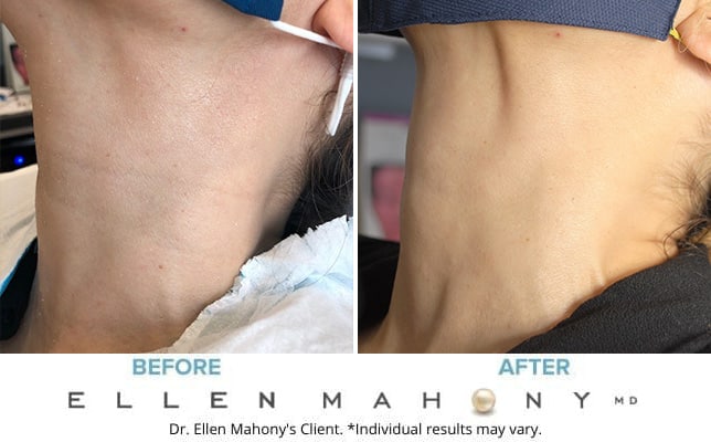 Before and After Image: Case #9165 - front