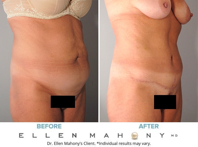 Before and After Image: Case #9182 - right-front-oblique