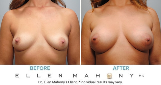 Before and After Image: Case #9216 - front