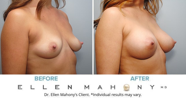 Before and After Image: Case #9216 - right-front-oblique