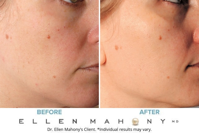 Before and After Image: Case #9278 - right-front-oblique
