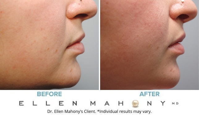 Before and After Image: Case #9485 - right-side