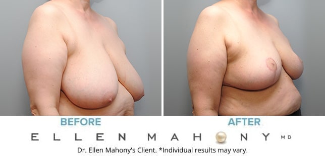 Before and After Image: Case #9569 - right-front-oblique