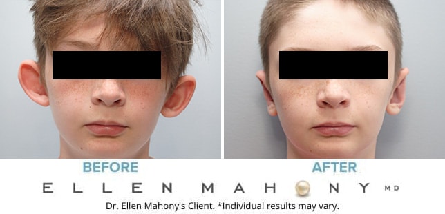 Before and After Image: Case #9707 - front