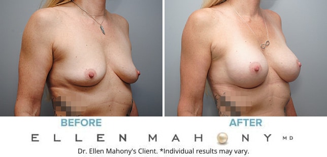 Before and After Image: Case #9987 - right-front-oblique