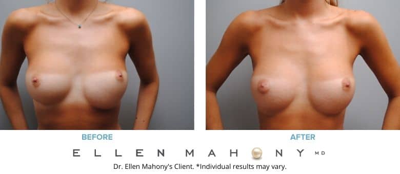 Before and After Image: Case #2765 - front