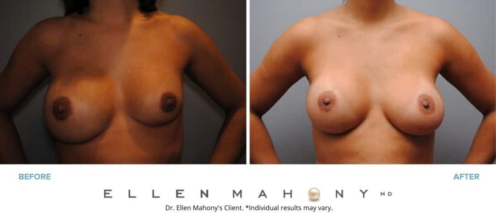 Before and After Image: Case #2959 - front