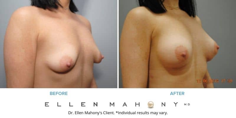 Before and After Image: Case #8577 - right-front-oblique