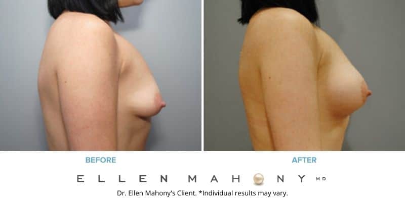 Before and After Image: Case #8577 - right-side