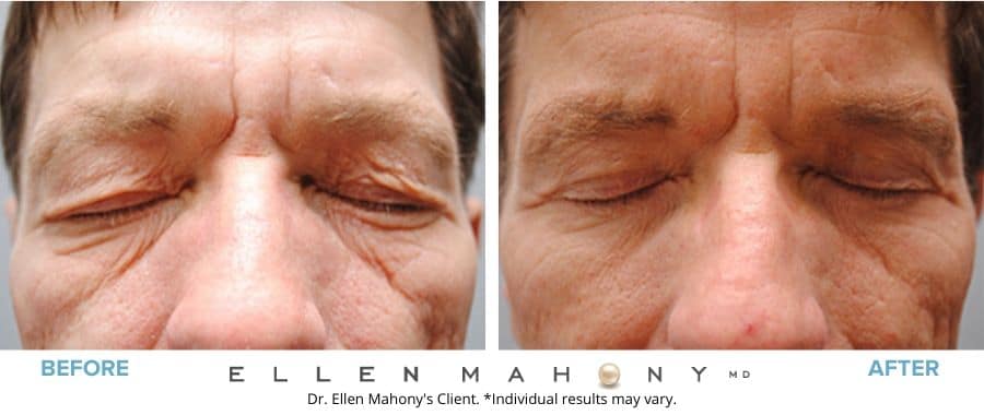 Before and After Image: Case #5066 - front