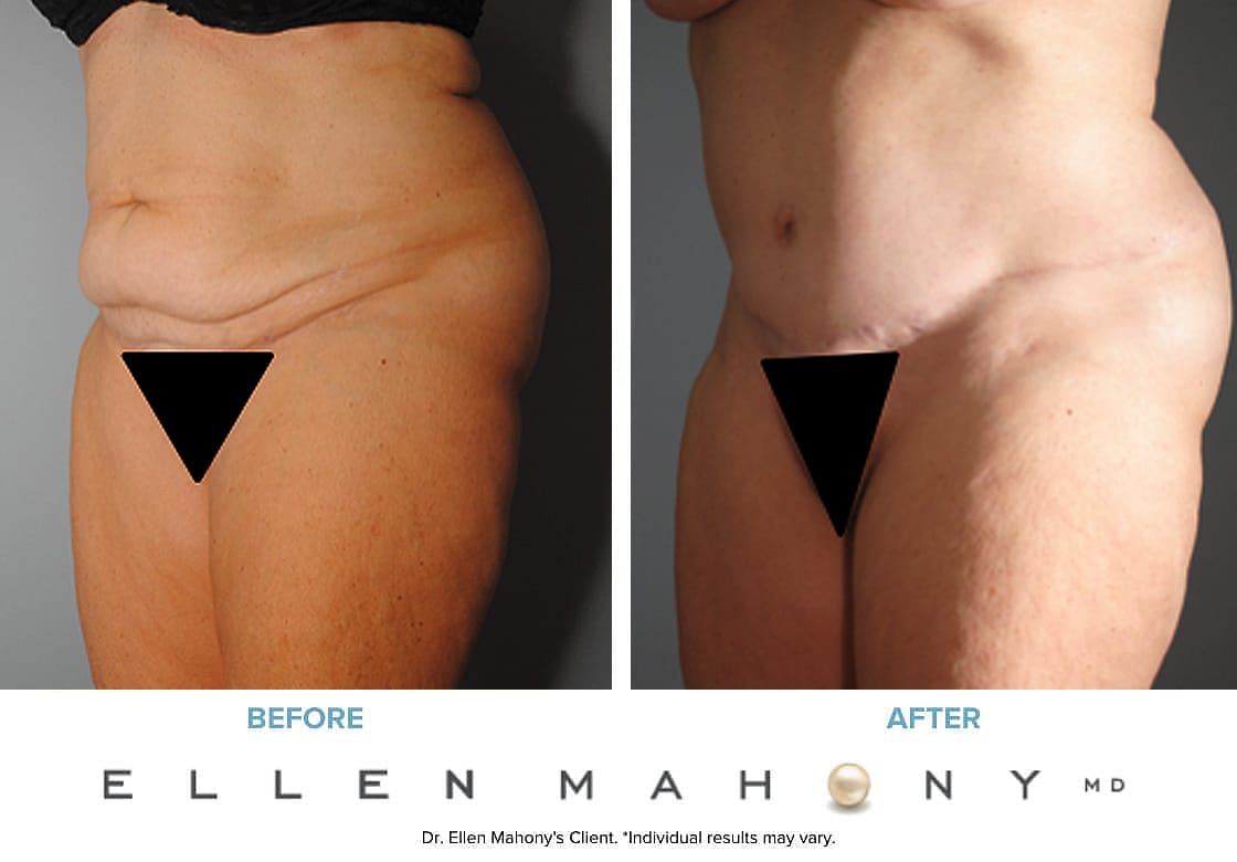 Before and After Image: Case #7681 - left-front-oblique