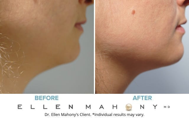 Before and After Image: Case #8955 - right-side