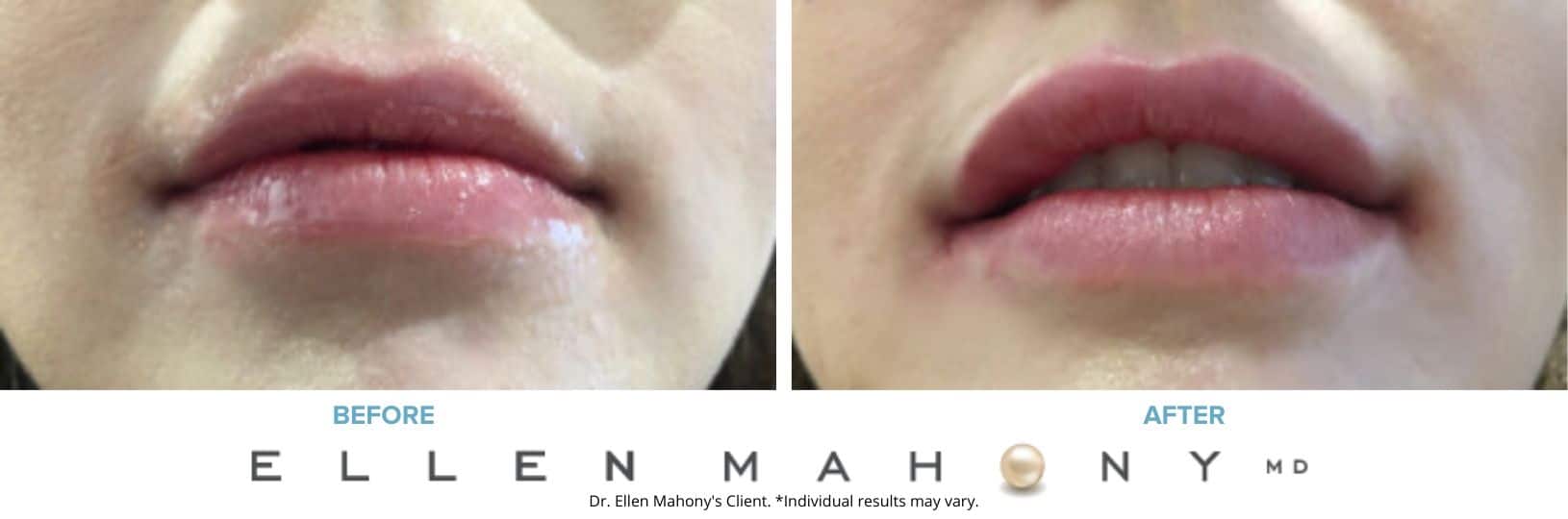 Before and After Image: Case #7331 - front