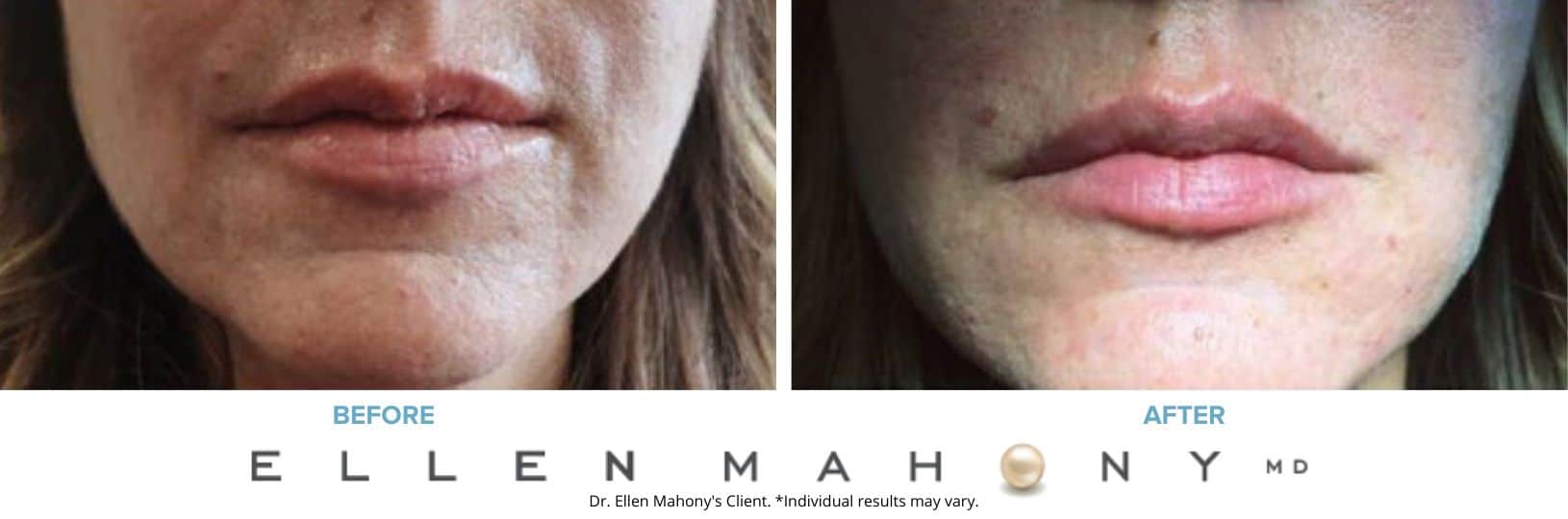 Before and After Image: Case #7440 - front