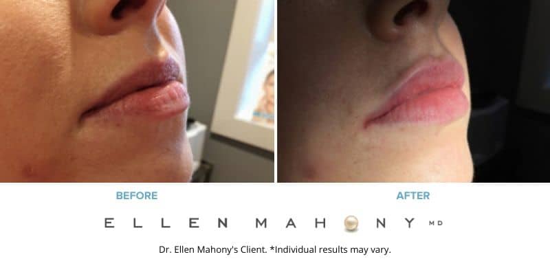 Before and After Image: Case #7567 - right-front-oblique