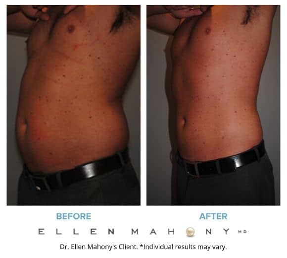 Before and After Image: Case #2155 - left-front-oblique