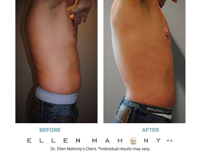 Before and After Image: Case #2186 - right-side
