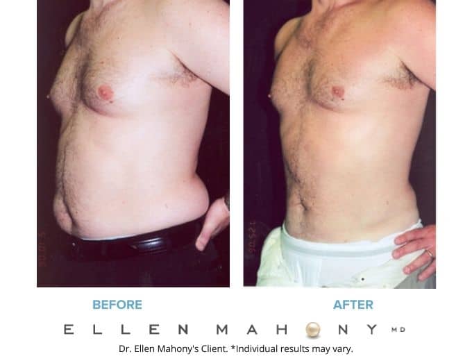 Before and After Image: Case #2279 - left-front-oblique