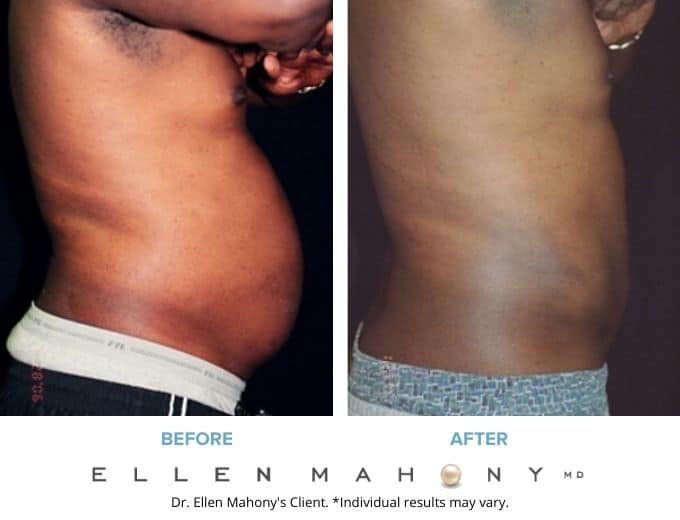 Before and After Image: Case #2286 - right-side