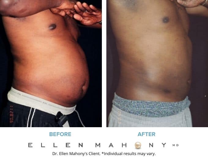 Before and After Image: Case #2286 - right-front-oblique