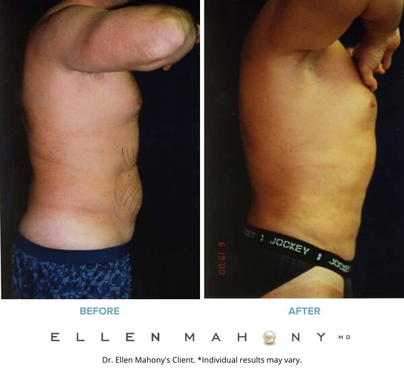 Before and After Image: Case #2358 - right-side