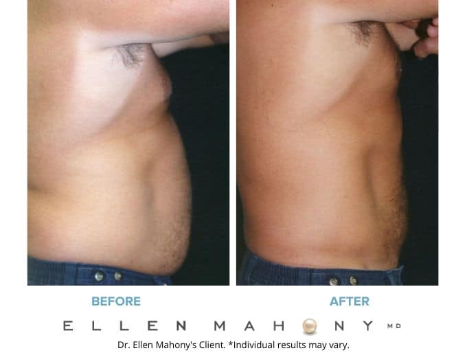 Before and After Image: Case #2372 - right-side