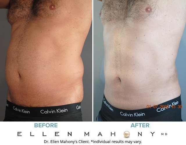Before and After Image: Case #8577 - left-front-oblique