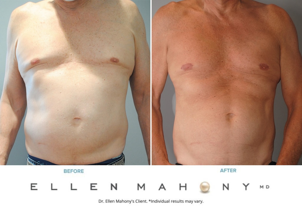 Before and After Image: Case #9751 - front