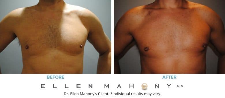 Before and After Image: Case #2537 - front