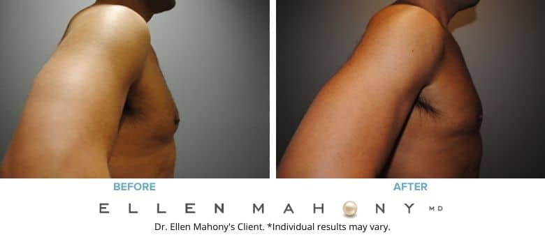 Before and After Image: Case #2537 - right-side