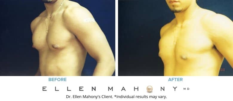 Before and After Image: Case #2549 - left-front-oblique
