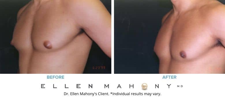 Before and After Image: Case #2556 - left-front-oblique