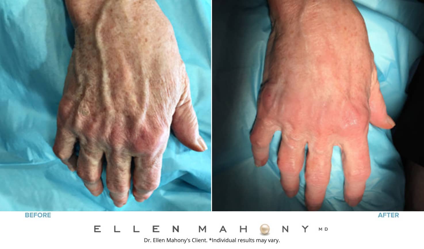 Before and After Image: Case #7556 - front
