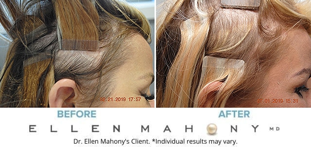 Before and After Image: Case #7970 - right-side