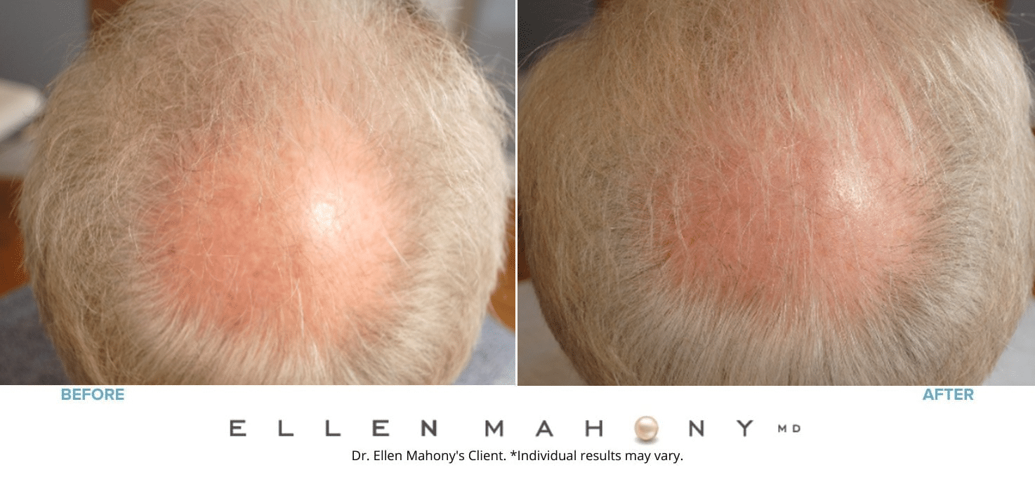 Before and After Image: Case #8165 - front