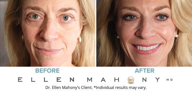Before and After Image: Case #8078 - front