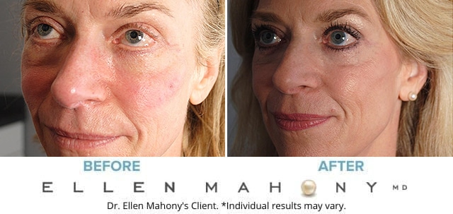 Before and After Image: Case #8078 - left-front-oblique