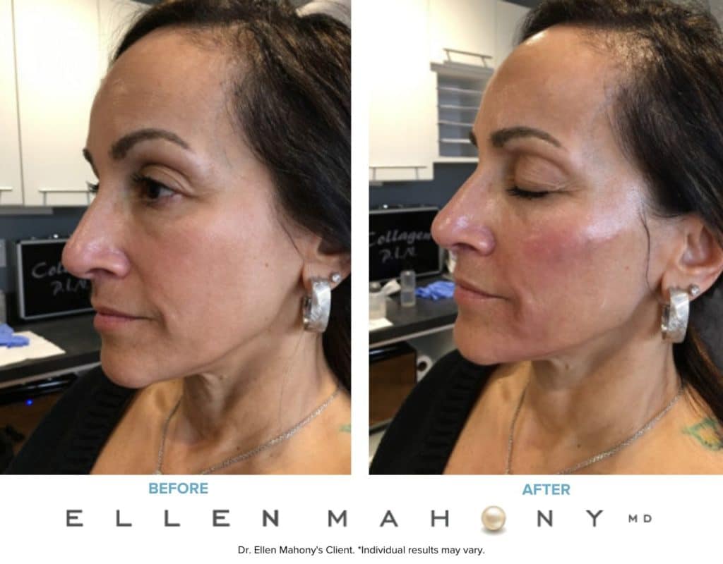 Before and After Image: Case #7609 - left-front-oblique