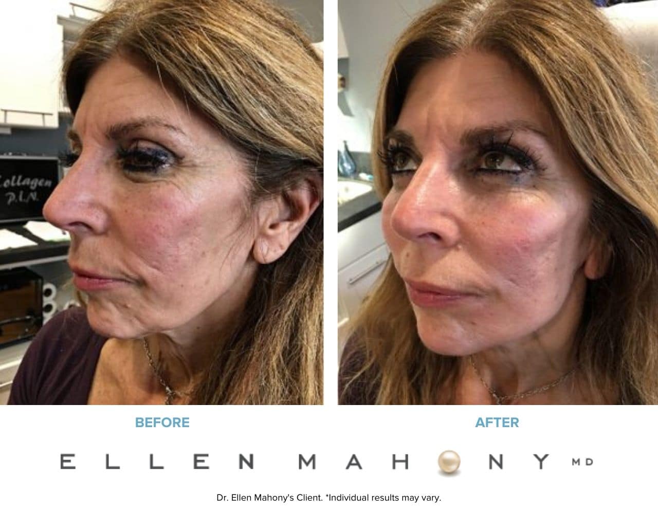 Before and After Image: Case #7686 - left-front-oblique