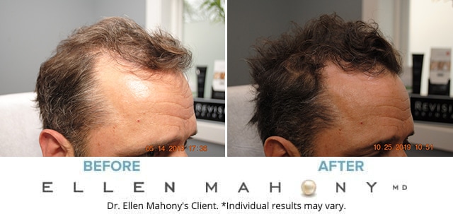 Before and After Image: Case #8210 - right-front-oblique