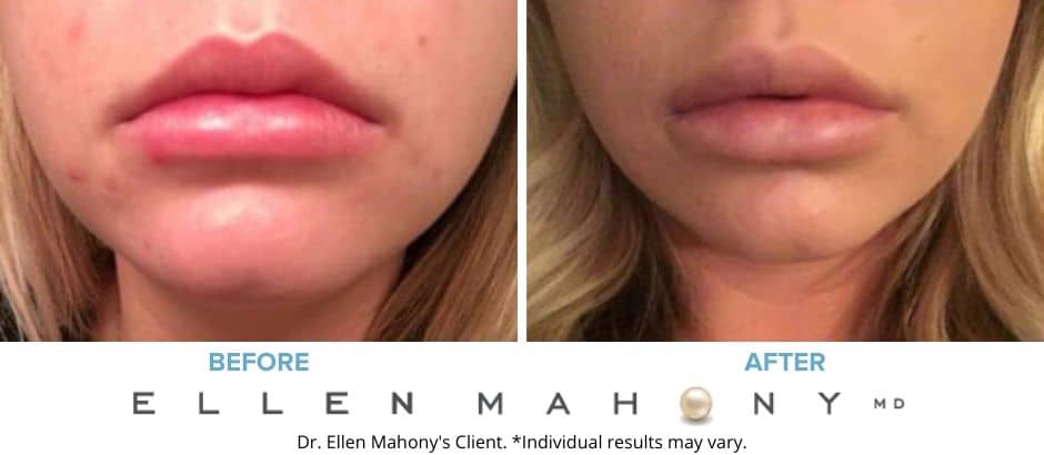 Before and After Image: Case #7436 - front
