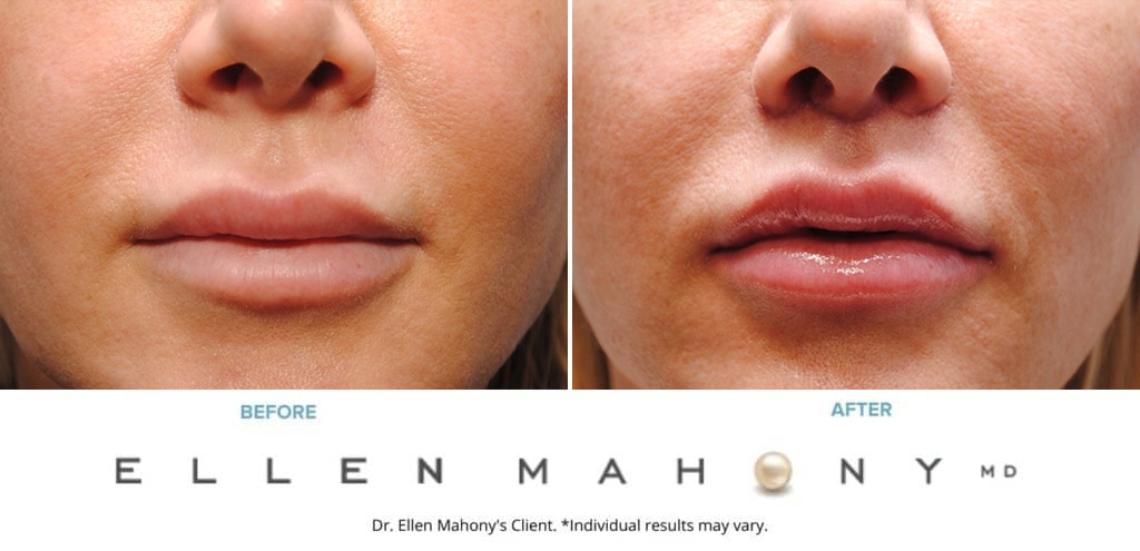 Before and After Image: Case #9508 - front