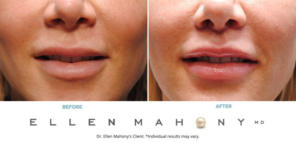 Before and After Image: Case #9508 - front