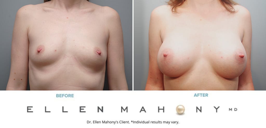Before and After Image: Case #10067 - front